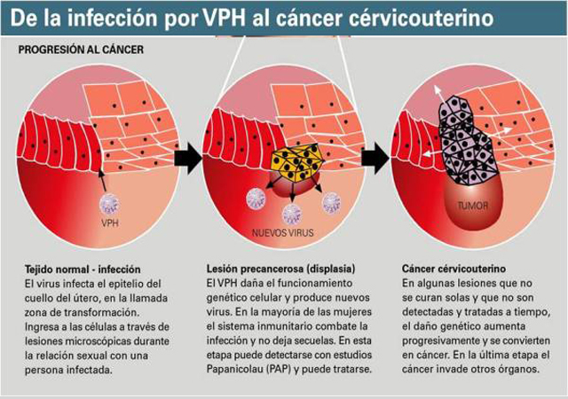 hpv
